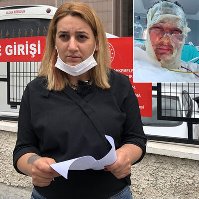 Kızgın yağ davasında karar!