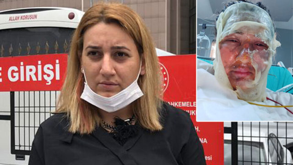 Kızgın yağ davasında karar!