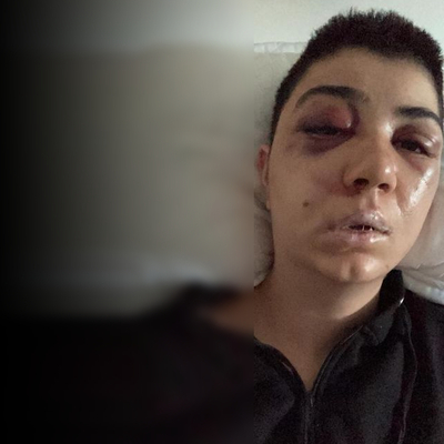 Nişan yemeği kabusa döndü! Saldırgan aramızda!