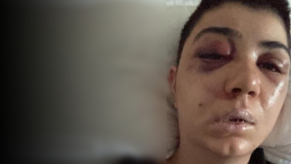 Nişan yemeği kabusa döndü! Saldırgan aramızda!