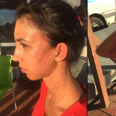 'Kalemle işkence' iddiasında yeni gelişme!