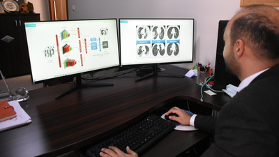 Yapay zekâyla Covid-19 tanısında yüzde 98'lik başarı