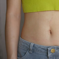 Göbek deliği temizliği nasıl yapılır?