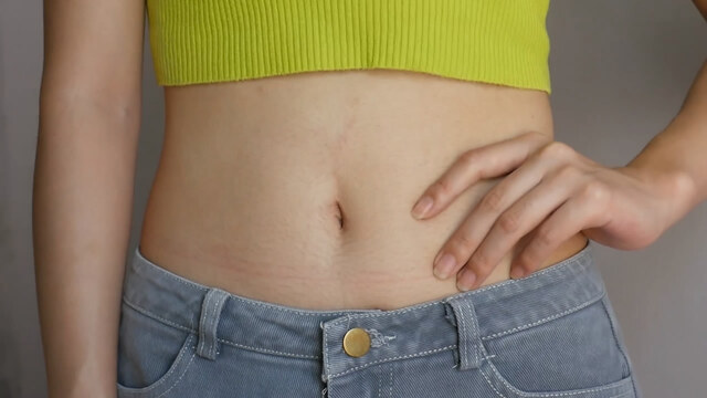 Göbek deliği temizliği nasıl yapılır?