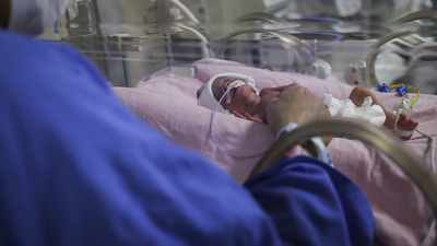 Ölüm riski bulunan üçüzlerden ikisi anne karnında ışın tedavisiyle kurtarıldı