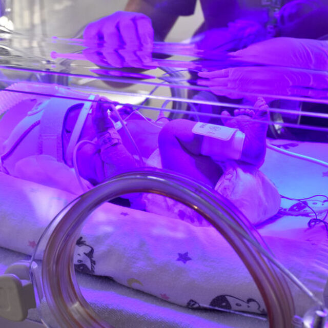 Her yıl, doğan bebeklerin yaklaşık yüzde 10'u prematüre