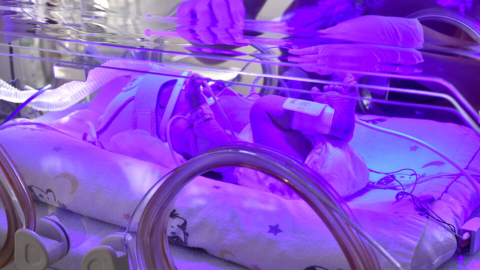 Her yıl, doğan bebeklerin yaklaşık yüzde 10'u prematüre