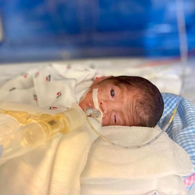 648 gram doğan Umut bebek hayata tutunmayı başardı