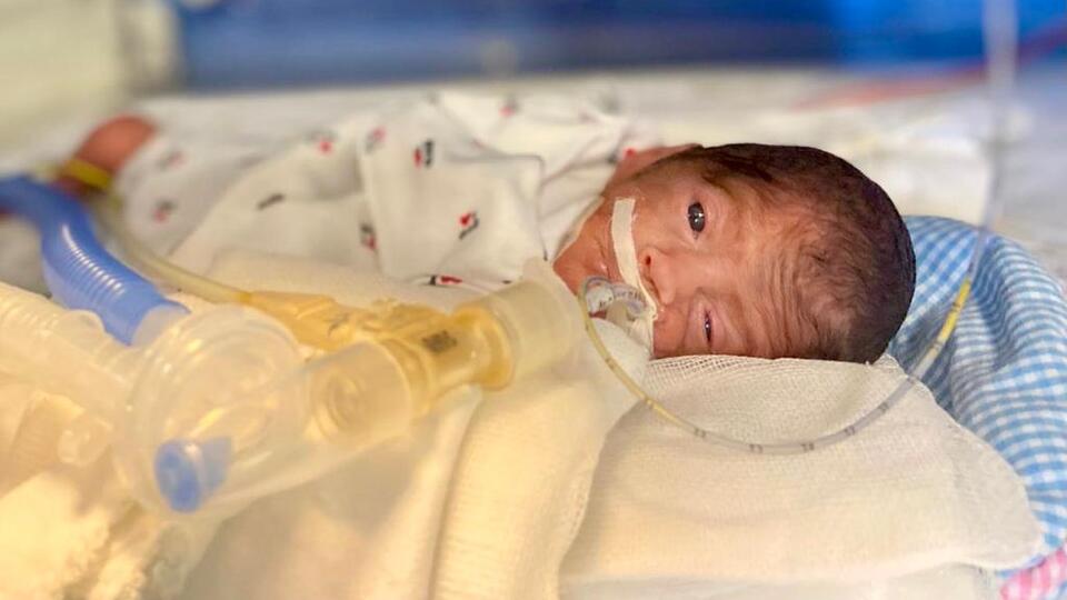 648 gram doğan Umut bebek hayata tutunmayı başardı