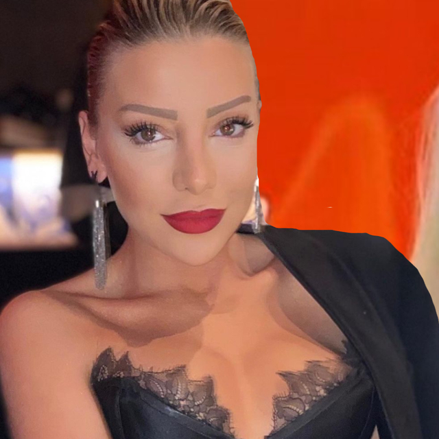 Gülşah Saraçoğlu'ndan 'estetik' itirafı!