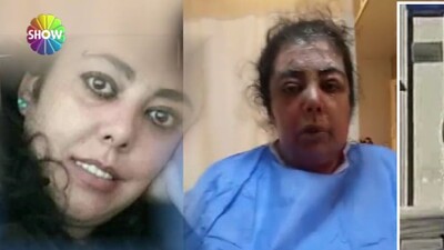 Kardeşinin üstüne kaynar su döktü