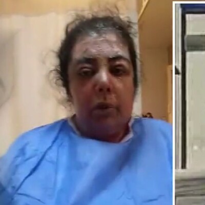 Kardeşinin üstüne kaynar su döktü