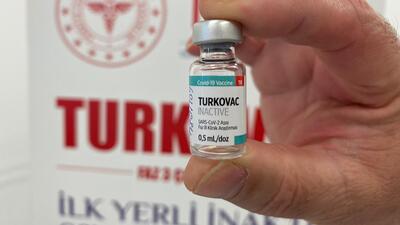 TURKOVAC ile ilgili 5 soru 5 cevap