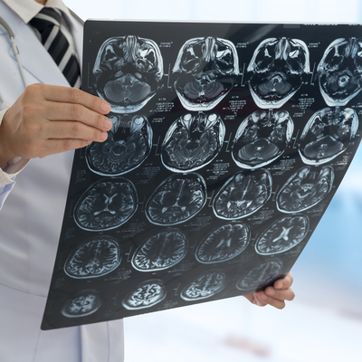 Kyoto Üniversitesi’nde ‘hafıza silme’ çalışması