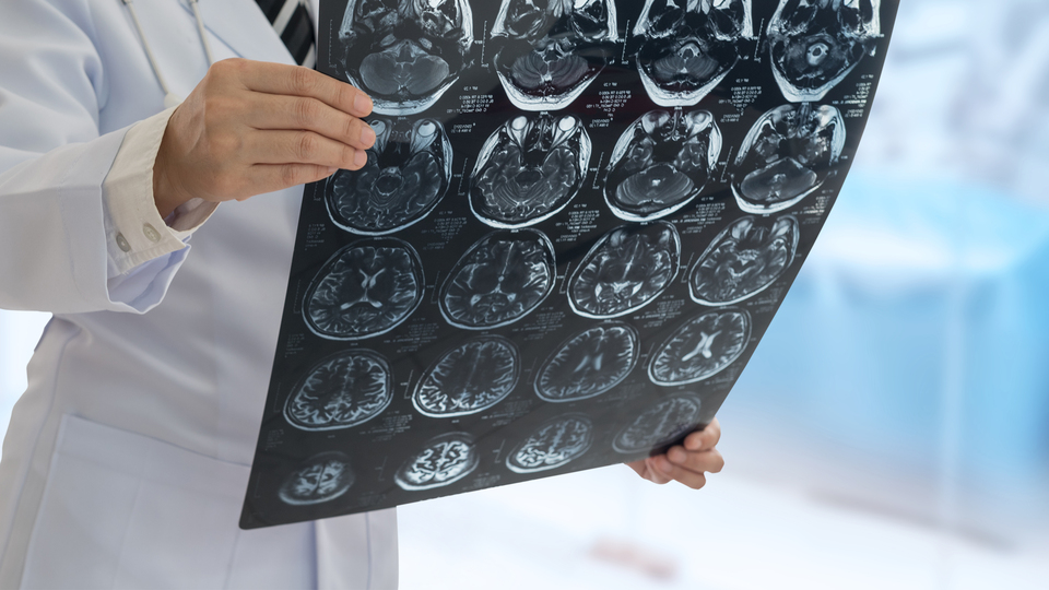 Kyoto Üniversitesi'nde 'hafıza silme' çalışması