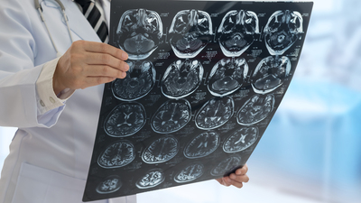 Nörolog bulamayabiliriz! O anketten korkutan sonuç