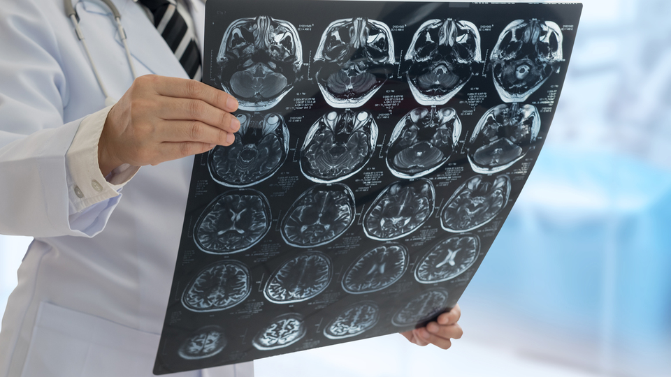 Nörolog bulamayabiliriz! O anketten korkutan sonuç