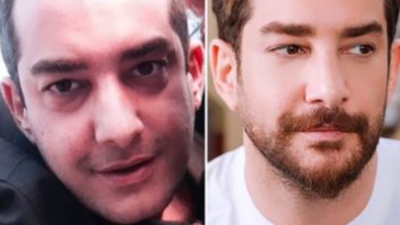 "Ben doğal güzelim!" dedi, tek tek açıkladı