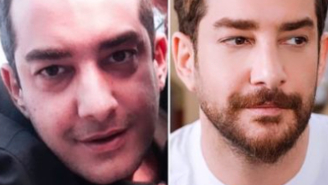 "Ben doğal güzelim!" dedi, tek tek açıkladı