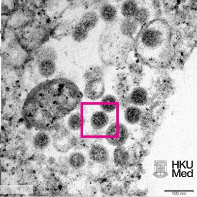 Omicron ilk kez görüntülendi