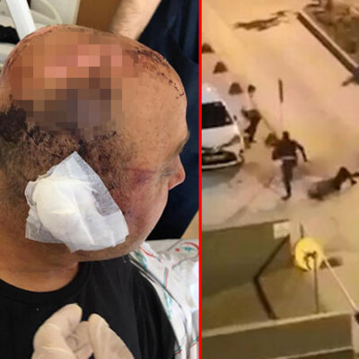 Polisi, telsiziyle öldüresiye döven sanığa istenen ceza belli oldu