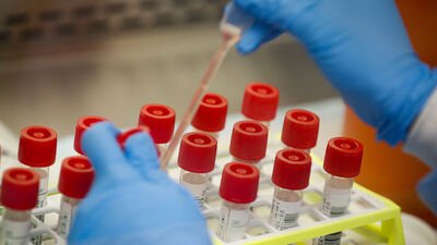 İnternetten COVID-19 sattı, tutuklandı