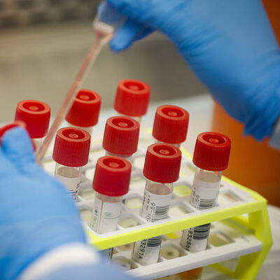 İnternetten COVID-19 sattı, tutuklandı