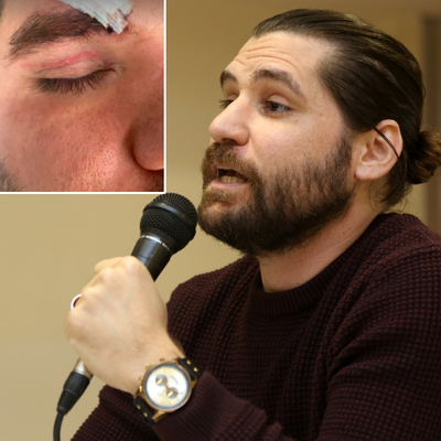 Ünlü oyuncu: Darp edildim!