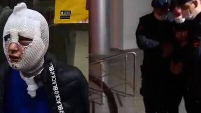 Cinsel saldırıda bulunup yüzüne kızgın yağ döktü