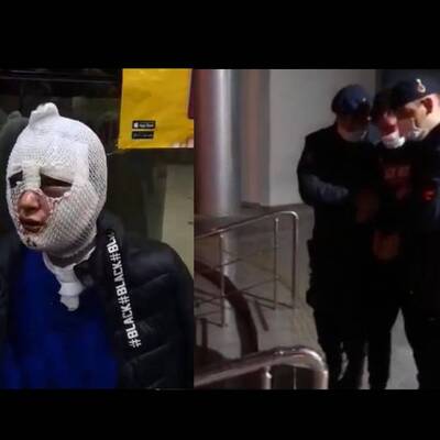 Cinsel saldırıda bulunup yüzüne kızgın yağ döktü