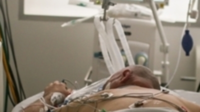 Covid-19, damar hastalıkları riskini artırıyor