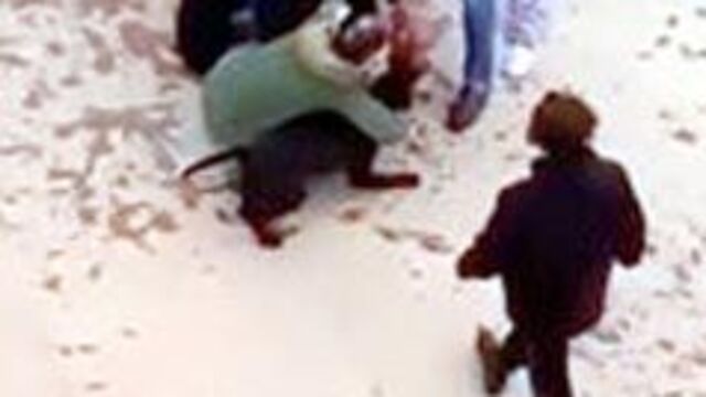 O anlar kamerada! 4 yaşında oyun oynuyordu! Pitbull dehşeti!