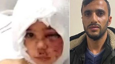 Tasmasız pitbull kurbanı Asiye'nin babası işten kovuldu!