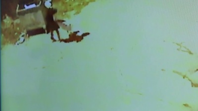 İki pitbull saldırısı daha! 3 kişi yaralandı