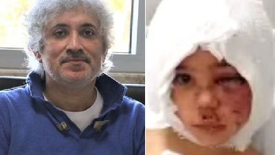 Prof. Dr. Ömer Özkan'dan açıklama! Asiye'den haber var!