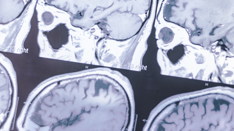 Yakın gelecekte beyin ile ilgili hangi gelişmeler yaşanacak?