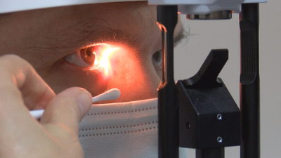 Adenovirüs alarmı! Şimdi de gözlerde başladı