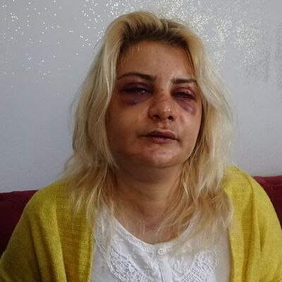 Yalnız yaşayan kadını darp ettiler!