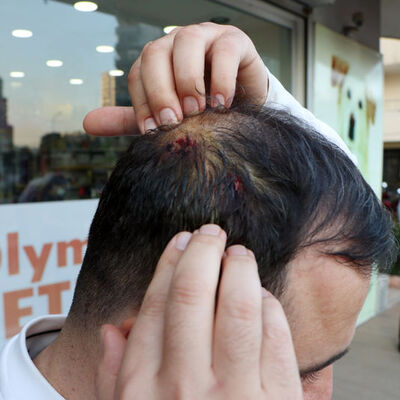 Veteriner hekimden coplu saldırı şikayeti