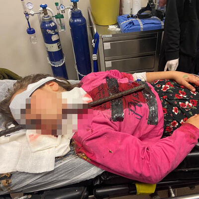 8 yaşındaki çocuğun boğazına demir çubuk saplandı!