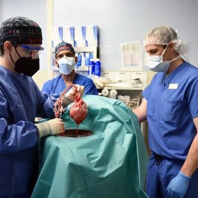 Domuzdan insana kalp nakli! İnsanlık için dev adım