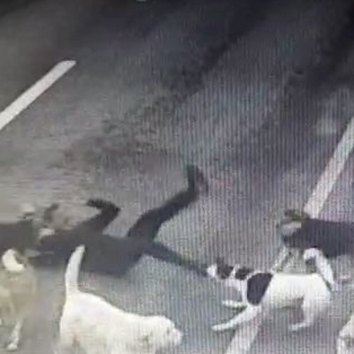 Sokak köpeklerinin saldırdığı iş adamı yaralandı