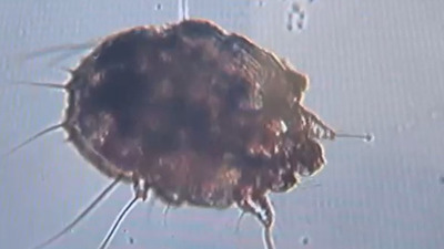 Dünya genelinde 'uyuz hastalığı' artışı uyarısı!