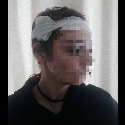 Üniversiteli genç kıza taşlı saldırı!