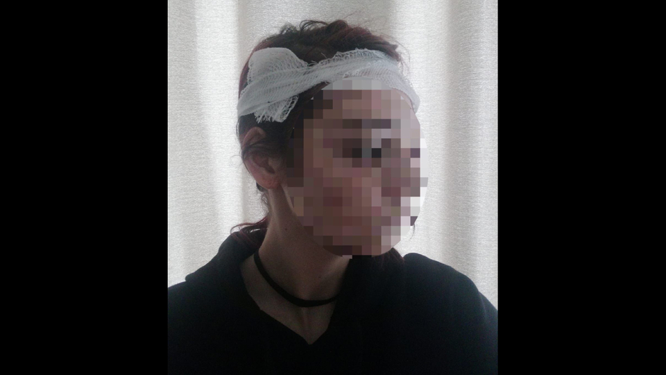 Üniversiteli genç kıza taşlı saldırı!