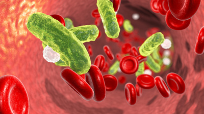 Çoklu organ yetmezliği nedir?