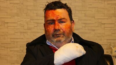 Uykuda dehşet! "Kız kardeşim yaptı!"