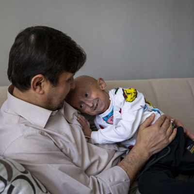 Türkiye'deki 4 kişiden biri! Bedeni hızla yaşlanıyor