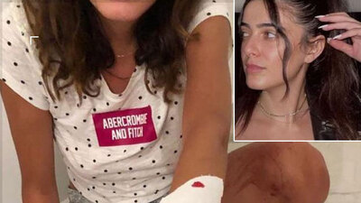 Kan donduran olay! Fenomene işkence!