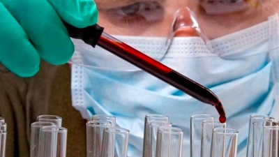 Covid'e bağlı emboli tehlikesi! O test ile önlenebilir